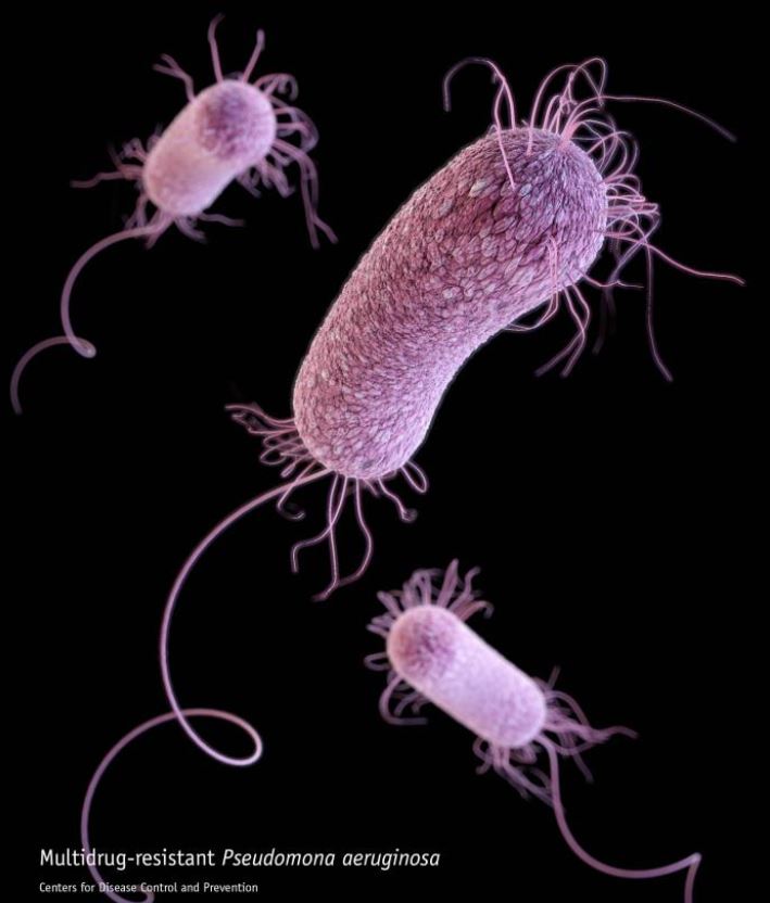 Highly resistant Pseudomonas strains found in Nigerian hospitals CIDRAP